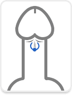 Das Frenulum-Piercing