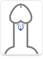 Frenulum-Piercing